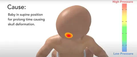 Natural Baby Flat Head Prevention - R.E.D Techniques