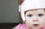 What Is Plagiocephaly & How Can It Be Treated?