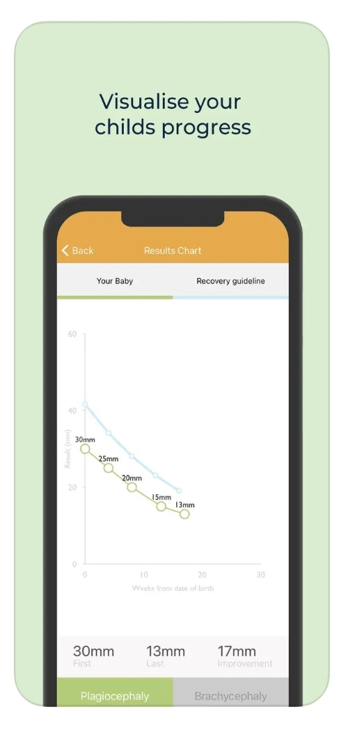 MIMOS Baby APP - Mobile Measuring and Recording Apps (FREE)