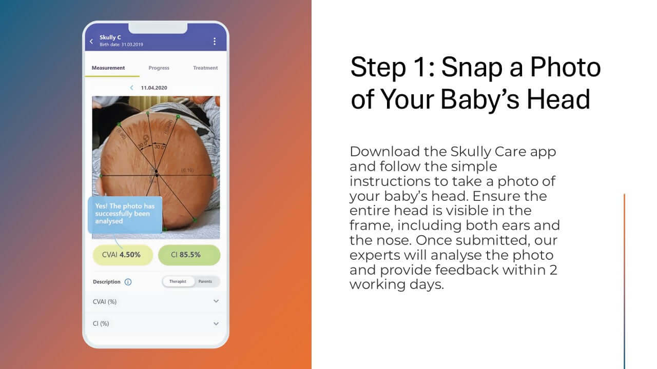 Skully Care: Head Shape Scan and Advise Package