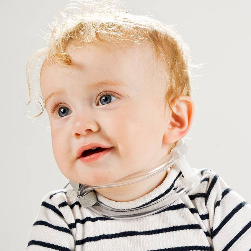 torticollis are often link the cause of the plagiocephaly. see how can you help to treat your baby if you suspect a tilt of the head on one side