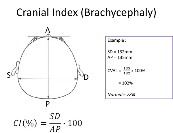 Brachycephaly deformity measurement and index calculation