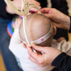 Measuring baby flat head severity with craniometer