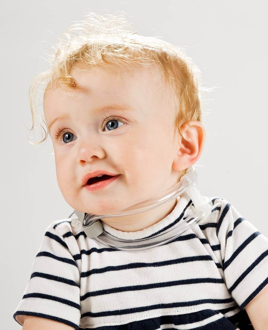 Baby using the TOT-Collar for Torticollis correction