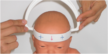 Measuring baby flat head severity with craniometer - Brachycephaly