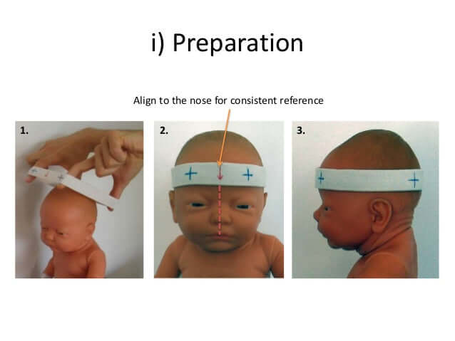 Elastic Measuring Band Version 2.0 for Craniometer (Pack of 10)