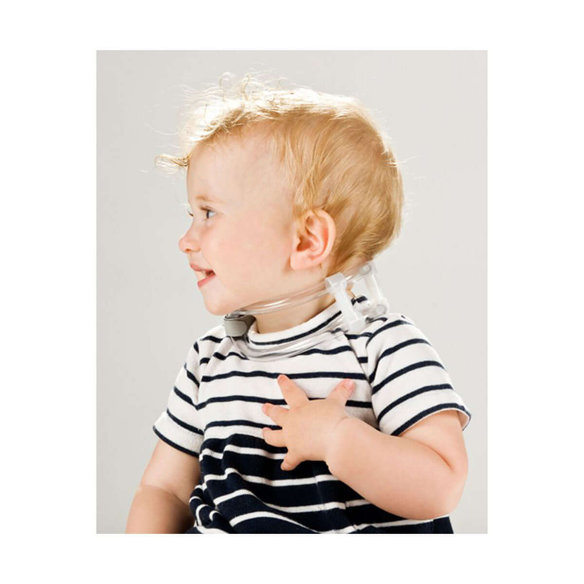 Correct baby Torticollis with TOT-Collar
